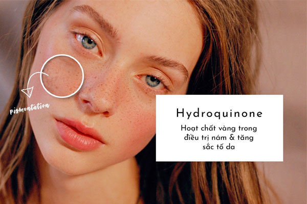 Hydroquinone là gì?