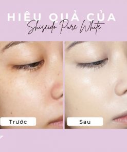 Vien Uong Trang Da Shiseido Pure White Nhat Ban 3