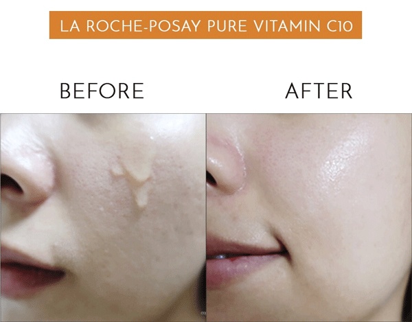Tinh chất La Roche-Posay Pure Vitamin C10 Serum có kết cấu đặc giúp da giữ ẩm được khá lâu, không bị khô da hay có dấu hiệu bị căng