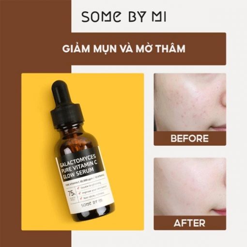 Tinh chat Some By Mi Galactomyces Pure Vitamin C Glow Serum 11